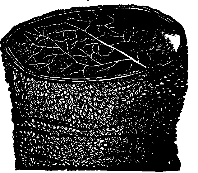 Illustration:
Fig. 31. A section of the Ileum, turned inside out,