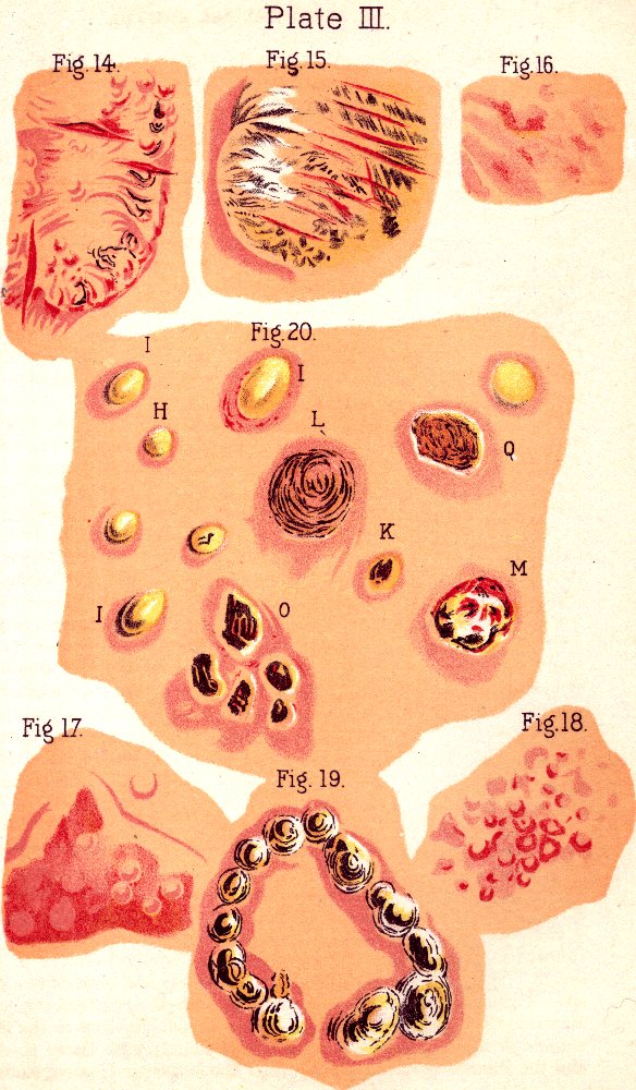 Illustration:
Plate III. Fig. 14. Fig. 15. Fig. 16. Fig. 20. Fig. 17. Fig. 19. Fig. 18.