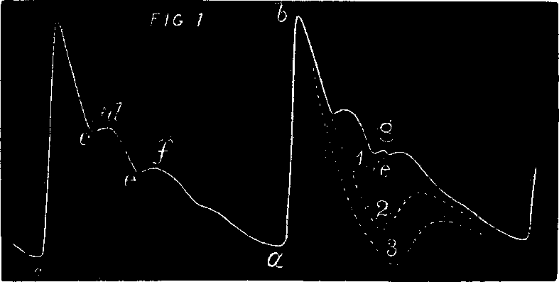 Illustration:
Fig. 2. The above is a representation of a tracing of a healthy pulse as
made with the Sphygmograph.