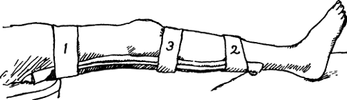 Fig. 26.