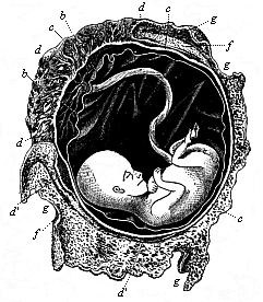 Fig.199. Human foetus, twelve weeks
old, with its membranes.