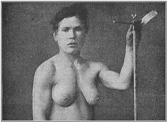 A Greek gynecomast.